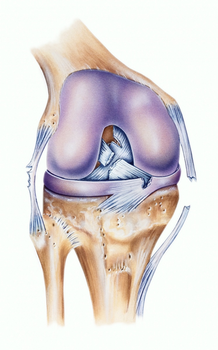 Basics of Hip, Thigh, Knee -- Live Webinar