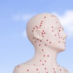 Essential Orthopedic Acupuncture Techniques and Modalities -- Distance-Learning Course